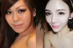网红照片整容,揭秘整容前后惊人变化